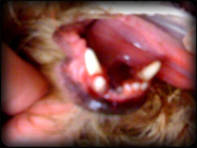 Blue-Purple tiny absorbable stitches are all that remain of the loose tooth and the painful root fragment