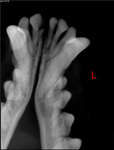 x-ray of Lower front middle incisor tooth missing and root fragment stuck in the jaw