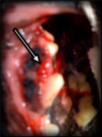 broken upper fourth premolar in a dog