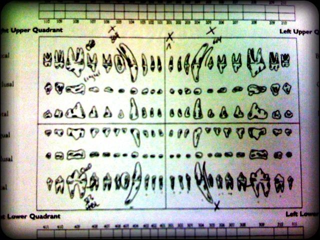 charting dog teeth A form showing drawings of the teeth lines up with spaces to record notes about each tooth. This is one way to "chart the teeth"