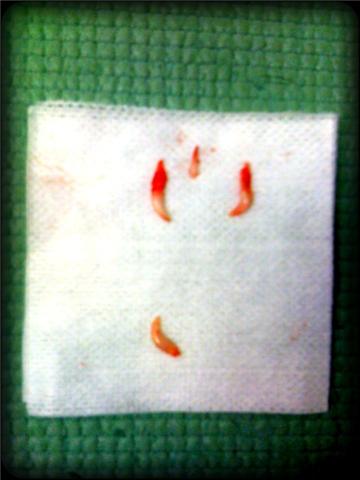 extracted baby teeth The four retained teeth from this chihuahua lined up on gauze