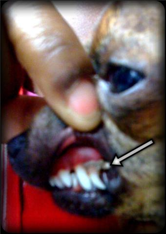 retained deciduous canine tooth A double upper canine tooth crowds the permanent tooth and fur and food stick in the crevice between the two teeth