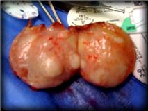 the tan lumpy cut surface section of the mix-breed labrador's skin tumor