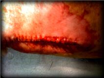 post lumpectomy suture line on a dog